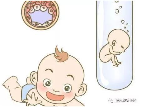 体外受精 IVF-ET